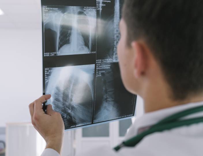 Doctor para fracturas